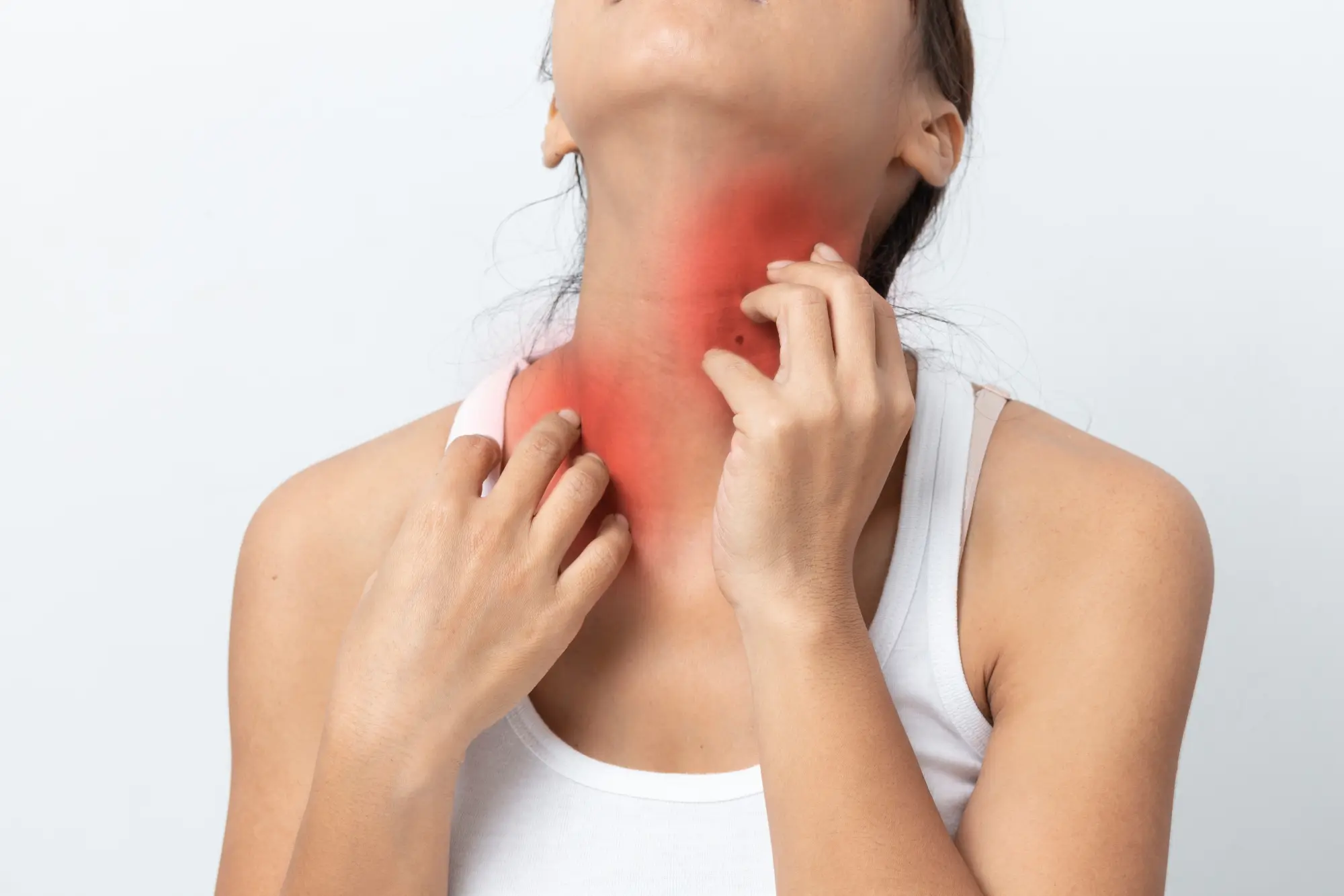 Biltmore Dermatology client with Dermatitis, Eczema or Skin Allergies